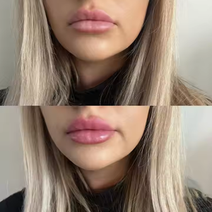 Hidratante para aumentar el volumen de los labios, aceite transparente que cambia de color según el pH, 20 ml, vegano, con ácido hialurónico, brillo voluminizador de labios, marca privada - Product Image 6