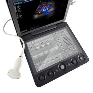 Escáner de Ultrasonido Portátil para Animales Sonoscape S9V de Alto Rendimiento para Diagnóstico en Granjas, Ganado y Clínicas Veterinarias - Product Image 4