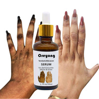 Toptan güzellik cilt bakımı renk açıcı Serum el knuckle kızdırma Serum koyu Knuckle Fingel kaldırma koyu Knuckle dirsek diz