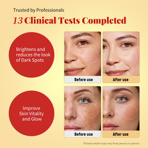 Illuminante sbiancante vitamina <span class=keywords><strong>C</strong></span> Niacinamide idratante siero viso con acido ialuronico rafforza la barriera cutanea - Product Image 5