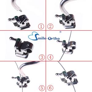 Chất Lượng Cao Nụ Mười-<span class=keywords><strong>Ortho</strong></span> Hoạt Động Tự <span class=keywords><strong>Ligating</strong></span> Roth/MBT Chân Đế 1S Nha Khoa Niềng Răng Chỉnh Hình Răng Chân Đế 0.022/0.018 - Product Image 4