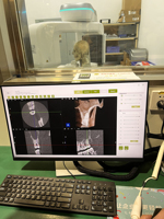 Solutions radiologiques dentaires 3-en-1 avec imagerie panoramique et céphalométrique CBCT pour la planification d'implants en milieu hospitalier et en clinique dentaire