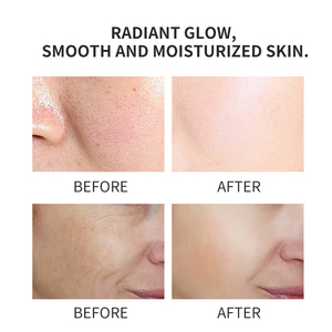 ウコンビタミンCコラーゲン,30mlオーガニックフェイシャルスキンケアコジック酸カタツムリフェイスセラム - Product Image 6