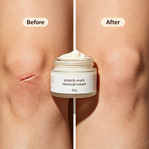 Crème Réparatrice Naturelle <span class=keywords><strong>Anti</strong></span>-Vergetures et Cicatrices Hydratant Corporel pour le Traitement des Vergetures et des Cicatrices de <span class=keywords><strong>Grossesse</strong></span> - Product Image 6