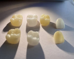 فرن تلبيد الزركونيا السريع عالي السعة بقوة 2000 واط للاستخدام في طب الأسنان - Product Image 6