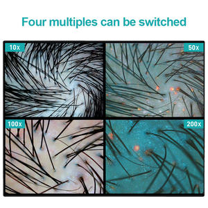 Intelligent AI Smart Hair and Scalp Détection de l'acide folique Microscope haute définition Analyseur de cheveux avec stockage de données en nuage - Product Image 6