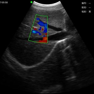 Sonde d'échographie Doppler linéaire portable vétérinaire à double tête 128 éléments, échographie Doppler couleur, sonde d'échographie médicale sans fil - Product Image 4