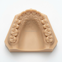 Modelo de Estudio Dental Personalizado para Alineadores SLA