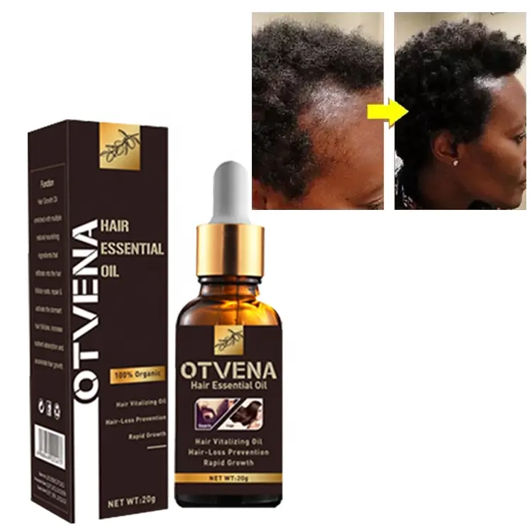 OTVENA 50PCS OEM customize best hair growth oil 4 times faster baldness treatment hair loss products