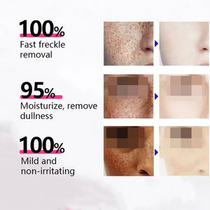 Crème anti-taches noires <span class=keywords><strong>pour</strong></span> le visage, crème éclaircissante et anti-<span class=keywords><strong>rides</strong></span>, produits de beauté <span class=keywords><strong>pour</strong></span> le visage, fabriqués par un fabricant de produits de soin certifié - Product Image 3