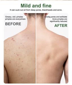 Barra <span class=keywords><strong>de</strong></span> jabón negra Natural <span class=keywords><strong>de</strong></span> alquitrán <span class=keywords><strong>de</strong></span> pino a base <span class=keywords><strong>de</strong></span> hierbas orgánicas <span class=keywords><strong>de</strong></span> Etiqueta Privada, efecto blanqueador hidratante sólido, esencial sin crueldad para hombres - Product Image 3