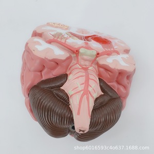 Modèle d'enseignement simulé de l'anatomie du cerveau ; outil pédagogique pour l'enseignement de l'anatomie pathologique du cerveau humain ; modèle des voies vasculaires et de la structure cérébrales - Product Image 4