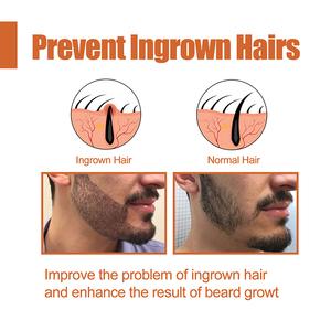 Huile de soin pour la croissance de la <span class=keywords><strong>barbe</strong></span>, soin naturel biologique à étiquette privée, personnalisée pour les hommes - Product Image 3