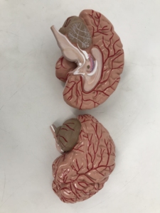<strong>Brain</strong> Model with Arteries - Product Image 2