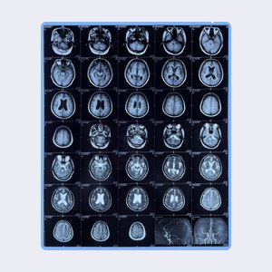 Синяя Тепловая рентгеновская пленка диагностическая медицинская сухая пленка для CT <span class=keywords><strong>DR</strong></span> MRI 8 "X10" 14 "X17" для Fuji AGFA HQ LUCKY Printers - Product Image 2