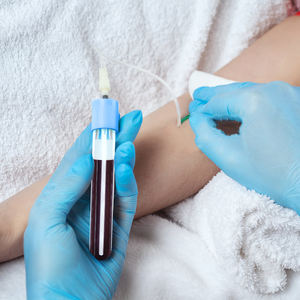 Kit de tube PET de 10 ml enduit ACD, thérapie par plasma riche en plaquettes, stérile et haute stabilité - Product Image 6