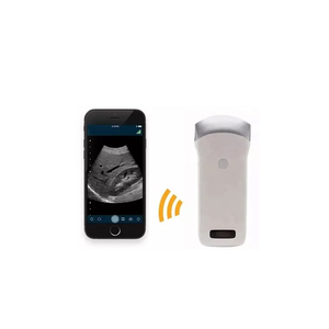 Escáner de sonda de ultrasonido B inalámbrico de matriz en fase convexa lineal de 80 elementos, instrumento veterinario para uso en hospitales/clínicas - Product Image 2