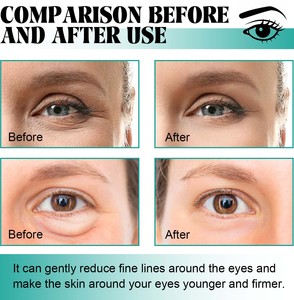 Masque pour les yeux en hydrogel de spiruline personnalisé, 60 pièces, hydratant, apaisant, usage quotidien pour les yeux gonflés - Product Image 5