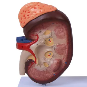 Plastisches Nieren nephron und Glomerulus modell einer menschlichen Niere