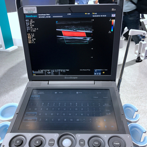 Sonoscape S9 Pro dengan Sonoscape Linear Probe <span class=keywords><strong>Echocardiography</strong></span> Ultrasound Machine - Product Image 3