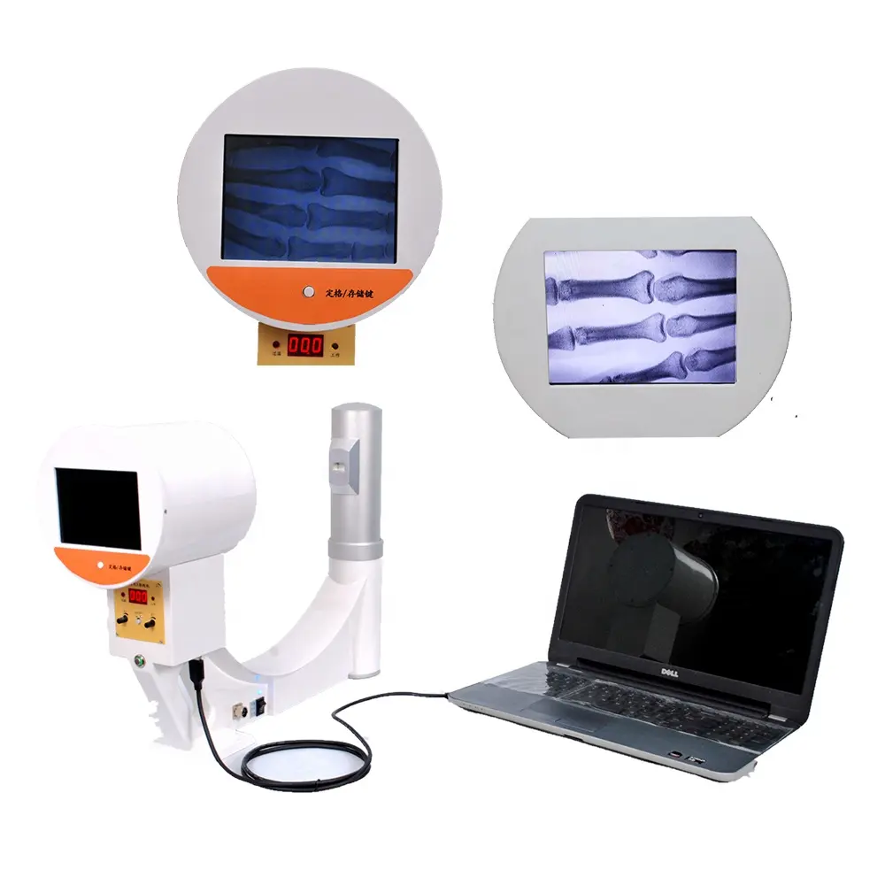 Máquina portátil de rayos x, fluoroscopia, MSLPX32