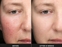 Brume hydratante pour le visage OEM, extrait de riz violet, PDRN rose, brume éclatante au DNA de saumon pour la fermeté du visage