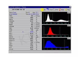 3-파트 차동식 수의학 혈액 분석기, KT-B042 <span class=keywords><strong>CBC</strong></span> 기기 (시간당 30회 검사 가능), 개, 고양이, 말 혈액 검사용 - Product Image 2