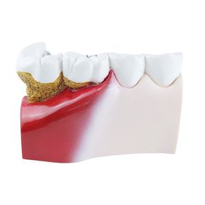Modelo de Entrenamiento Dental 1.5X para Coronas y Cavidades, Simulador de Anatomía Dental para Preparación, Restauración y Enseñanza - Product Image 1