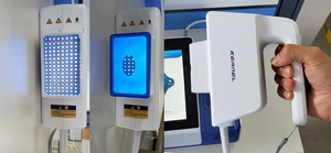 2025 modelo más nuevo médico Real 308nm Xecl Excimer equipo láser Led filtros especiales tratar <span class=keywords><strong>eczema</strong></span> vitiligo enfermedades de la <span class=keywords><strong>piel</strong></span> - Product Image 5