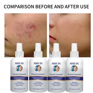 Crema limpiadora <span class=keywords><strong>Facial</strong></span> para el acné de etiqueta privada, ácido hipocloroso, eliminación de acné, piel, atletas, post entrenamiento, enrojecimiento y secado de bacterias - Product Image 4