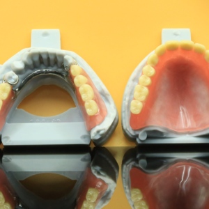 Metaal 3D-dentale print, compact en stevig, gemaakt van kobalt-chroomlegering - Product Image 2