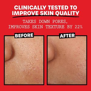 Medicube – Soin liquide coréen anti-âge pour le visage à l'<span class=keywords><strong>aloe</strong></span> <span class=keywords><strong>vera</strong></span> et 21 % d'agent exfoliant acide (AHA) – Améliore l'état de la <span class=keywords><strong>peau</strong></span> - Product Image 2