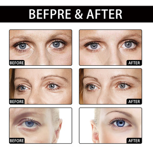 Venta al por mayor Protect Eys Moisture Repair the Bottom of the Eye Muscles Reduce Dark Spots Eye Gel Patch - Product Image 5