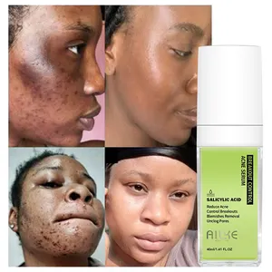 Skin Beauty-Salicylic Acid Facial Serum, Anti-Acne Treatment, Prevent Breakout Remover, Blackhead Whitening, 2%