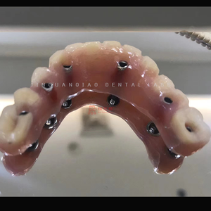 ทันตกรรมรากฟันเทียมทางคลินิกที่มีครอบฟันเซอร์โคเนียและกรอบไทเทเนียมครอบฟันพอร์ซเลนโคบอลต์และโครเมี่ยม - Product Image 3