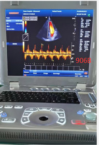 15 inch <strong>Colour</strong> <strong>Doppler</strong> Cardiac CW TDI Ultrasound Scanner Portable <strong>Echocardiography</strong> Machine - Product Image 2
