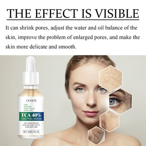 Siero Esfoliante 40% <span class=keywords><strong>TCA</strong></span>: Riduce i Pori, Chiude i Pori Dilatati, Ammorbidisce la Cuticola del <span class=keywords><strong>Viso</strong></span> e Idrata la Pelle - Essenza Unisex - Product Image 4