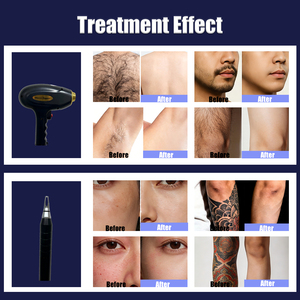 2026 New 2 In1 Blackhead Removal Pore Cleanings Tattoo Removal and 3 Wavelength Diode Lase Hair Removal Machine - Product Image 3