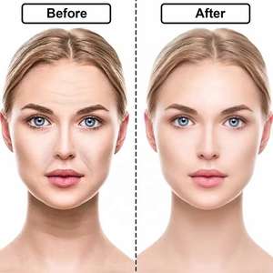 अनुकूलित रंग का लोगो सिलिकॉन विरोधी-झुर्रियों को कम करने के लिए पुनः प्रयोज्य फेस पैड पुनः प्रयोज्य फेस पैड - Product Image 2