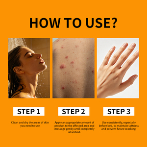 Crema de Alta Calidad para el Cuidado Corporal con Extracto Herbal Natural, Nutritiva y Reparadora para Piel Dañada, Fórmula en Tubo para Piel Sensible y Psoriasis - Product Image 5