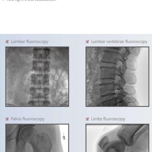 High Quality Low Price Mobile X-ray Radiography Machine Digital Image Intensifier FPD C-arm System CMX-118F - Product Image 6