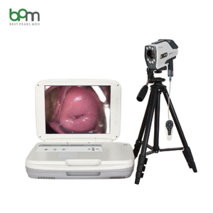 Sistem <span class=keywords><strong>Colposcope</strong></span> Video optik <span class=keywords><strong>Digital</strong></span> ginekologi kinerja biaya terbaik - Product Image 4