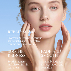 KORMESIC Marque Privée Vente en Gros 150g 5% Peroxyde de Benzoyle Mousse Nettoyante Anti-Acné et Réparatrice pour le Visage - Product Image 2