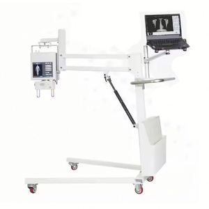 高エネルギー<span class=keywords><strong>X</strong></span>線装置医療DR <span class=keywords><strong>X</strong></span>線デジタル撮影システム整形外科用工場価格 - Product Image 4