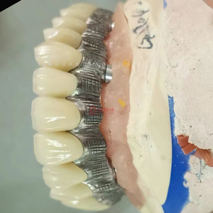 Ponte dentario contemporaneo dell'impianto ad arco pieno dentale a ponte di <span class=keywords><strong>Zirconia</strong></span> con qualità ottimale - Product Image 5