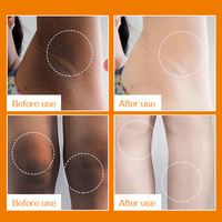 Crème Blanchissante pour Aisselles Noires à la Vitamine C, Traitement Coréen 60g, Pommade Rafraîchissante pour les Aisselles