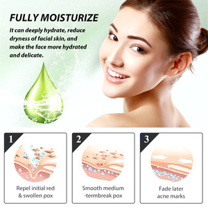 OEM Factory <strong>Price</strong> Private Label for All Skin Types Achieve Acne-Free Skin with Herbal Acne Serum and Face Care Cream - Product Image 5