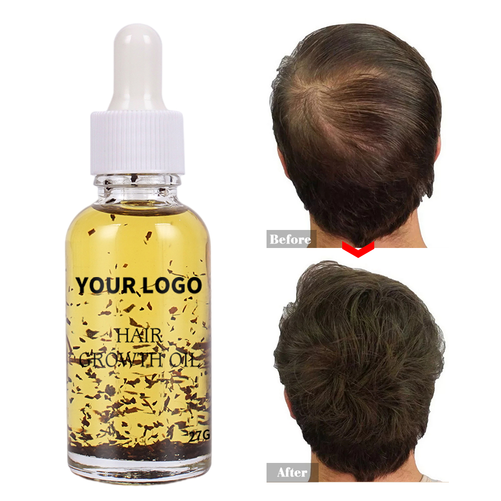Продукты для выпадения волос, натуральная формула на заказ, питательная сыворотка для роста волос, для кожи головы, масло для роста волос Elixirs