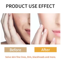 Ensemble de produits de soin de la peau pour le visage à l'essence de curcuma avec logo personnalisé, éclaircissant, hydratant, anti-acné, cosmétiques de beauté, kit de soin de la peau du visage