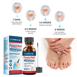 Solución líquida reparadora de <span class=keywords><strong>uñas</strong></span> de 10ml para limpiar, blanquear, nutrir y tratar hongos <span class=keywords><strong>en</strong></span> <span class=keywords><strong>las</strong></span> <span class=keywords><strong>uñas</strong></span> de los dedos de los pies - Product Image 5